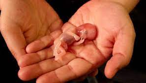  Avortement : comprendre ses conséquences et bienfaits