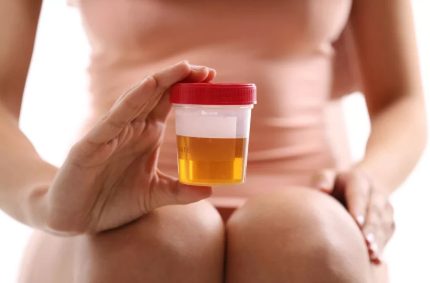  Comprendre les infections urinaires : symptômes, traitement et prévention