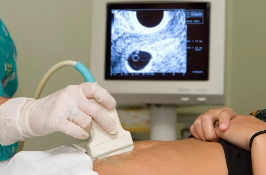  Comprendre la grossesse ectopique : symptômes, risques et traitements