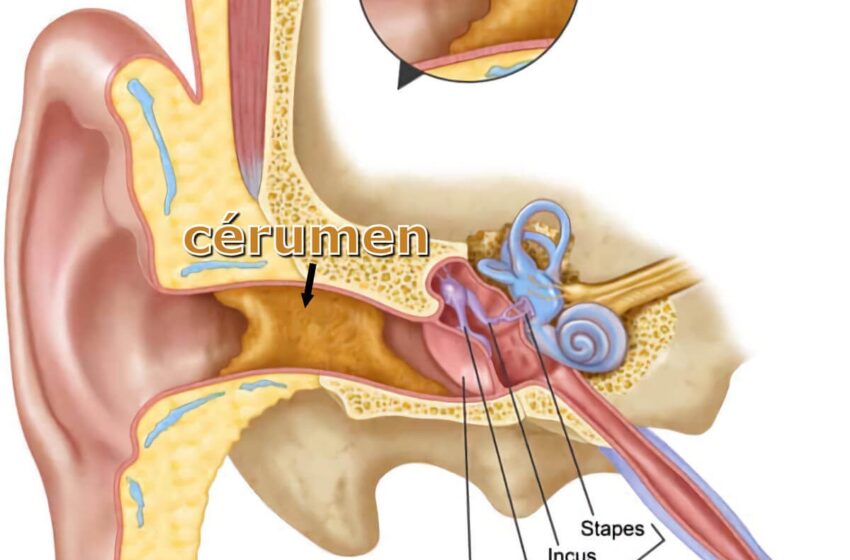  Le cérumen : un bouclier naturel pour votre santé auditive