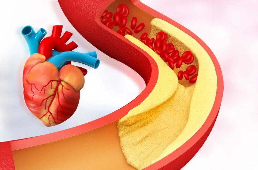 Comprendre le cholestérol : un enjeu clé pour la santé