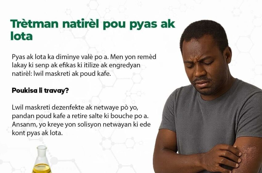  Trètman natirèl pou pyas ak lota
