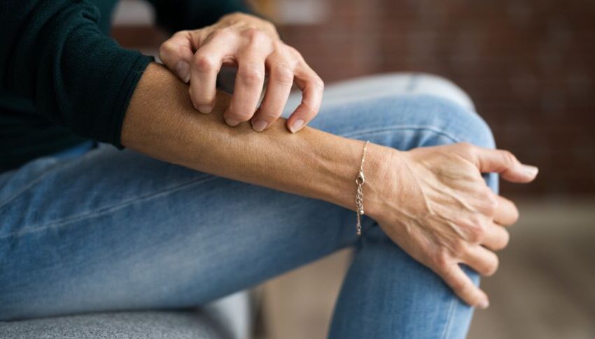  La gale : causes, symptômes et traitements