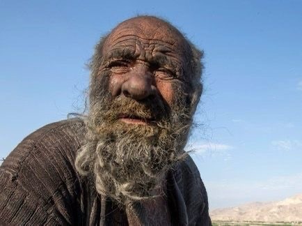  Saviez-vous qu’Amou Haji a passé plus de 60 ans sans se baigner et était la personne la plus sale du monde ?