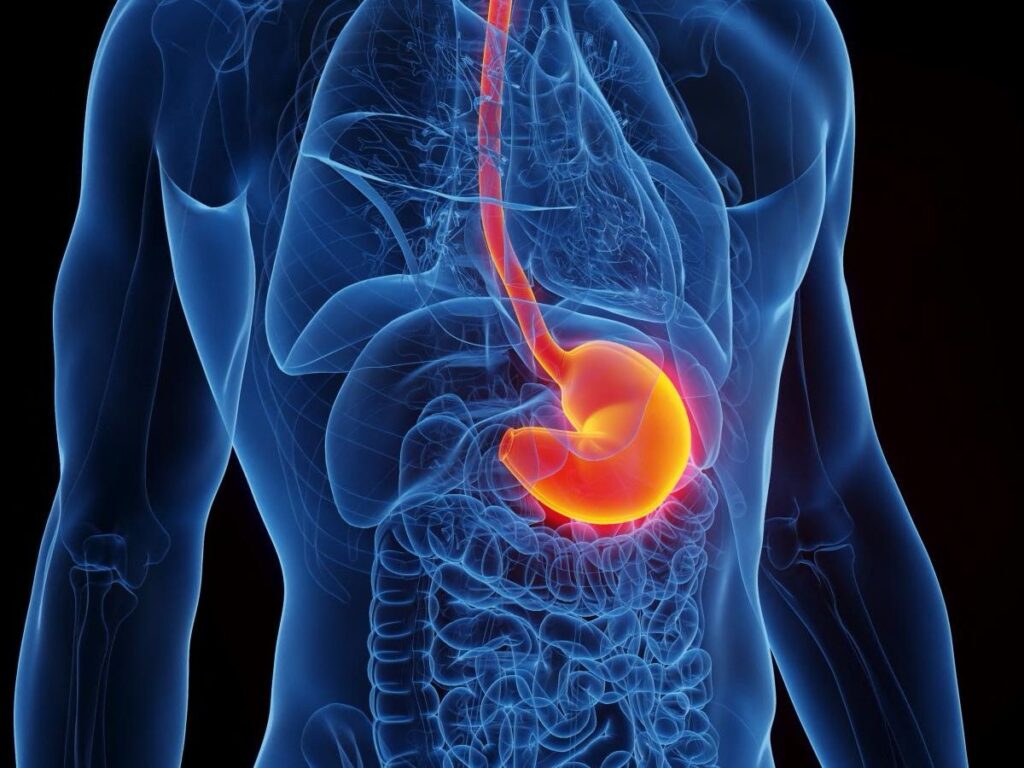 Comprendre et gérer les brûlures d&rsquo;estomac : conseils de santé