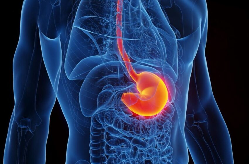  Comprendre et gérer les brûlures d’estomac : conseils de santé