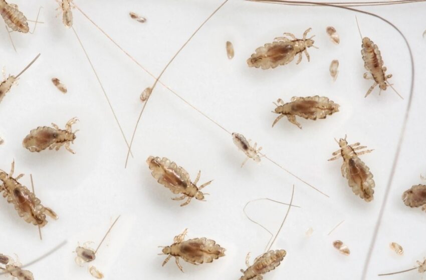  Poux : comprendre, prévenir et traiter les infestations