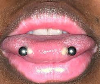  Piercing de la langue : un style à risques pour la santé