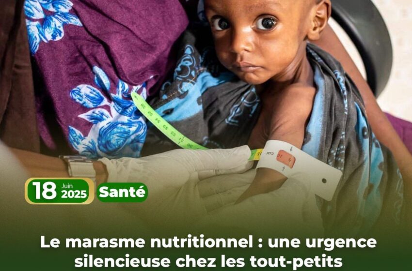  Le marasme nutritionnel : une urgence silencieuse chez les tout-petits