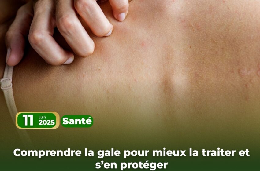  Comprendre la gale pour mieux la traiter et s’en protéger